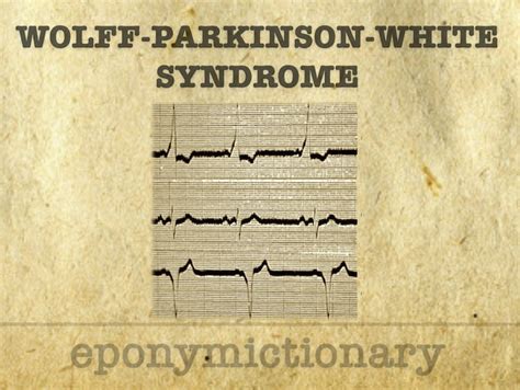wolf parkinson syndrome litfl